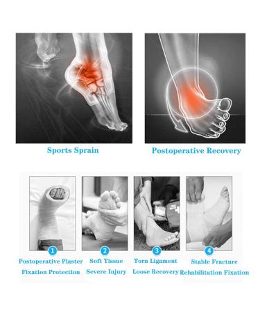 Buy SFKLYU Foot Drop Brace Splint - Ankle Support for Flat Feet Stroke Recovery & Postoperative Care | Removable Bandage | Left & Right Fit - Buy Online on GoSupps.com