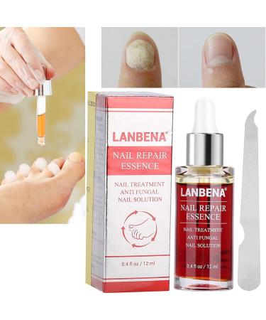 Nail Repair Essence 12ML - Powerful Anti-Fungus Treatment for Healthy Nails - Buy Online on GoSupps.com