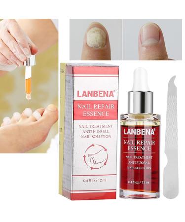 Nail Repair Essence 12ml - Natural Anti-fungus Treatment for Effective Nail Repair - Buy Online on GoSupps.com