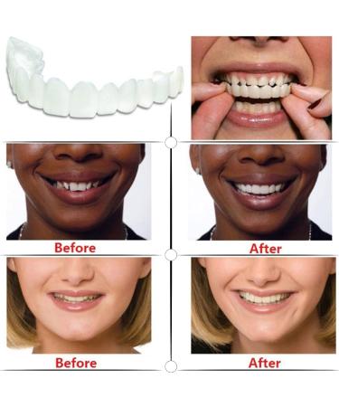 Rompa Veneers - 2 Pairs of Plug-In Fake Teeth for Men & Women | Cover Bad Teeth & Enhance Smiles - Buy Online on GoSupps.com
