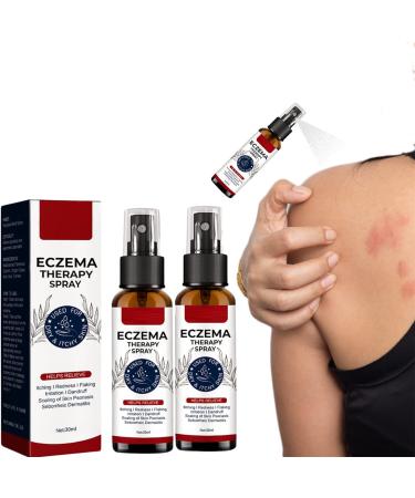 DUBUSH 2023 Eczema Therapy Spray Natural Eczema Relief Spray Eczema Hydrating Cream for Fast Acting Itch Relie Soothe Dry Skin 2pcs