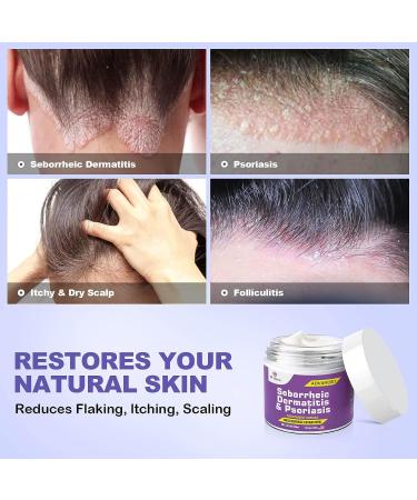 Dr. DERM Seborrheic Dermatitis Cream - Psoriasis Scalp Treatment for Folliculitis, Dry Scalp & Dandruff - Anti-Itch & Soothing Relief - 3.4 Fl Oz - Buy Online on GoSupps.com