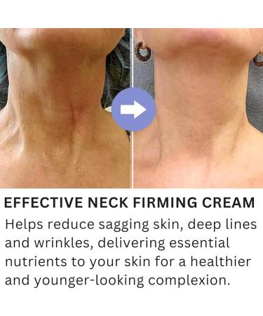 Tighten Lift Neck Cream Tighten & Lift Firming Neck Cream Neck Cream Tighten & Lift New Pure Tighten & Lift Neck Cream Neck Cream For Sagging And Tighten Tightening and Repair Decolletage Cream - Buy Online on GoSupps.com