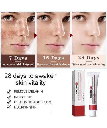 Dark Spot Remover for Face & Body Age Spot Remover for Face Spot Cream Dark Spot Corrector Hyperpigmentation Treatment Freckle Remover Cream Formulated with Nicotinamide Vitamin E Glycerol - Buy Online on GoSupps.com