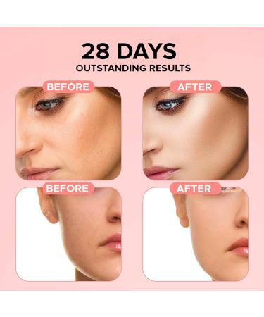 Niacinamide Pure Serum Pore Reducer Face Serum Niacinamide Serum Shrinking Enlarged Pores Serums Skincare Brightening Serum Face Serum For Women Balancing Sebum Production 15ml - Buy Online on GoSupps.com