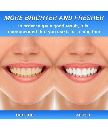 Body Accel Niacinamide Whitening Toothpaste - Stain Removal & Fresh Breath | 2PCs (50g) - International Shipping Available - Buy Online on GoSupps.com