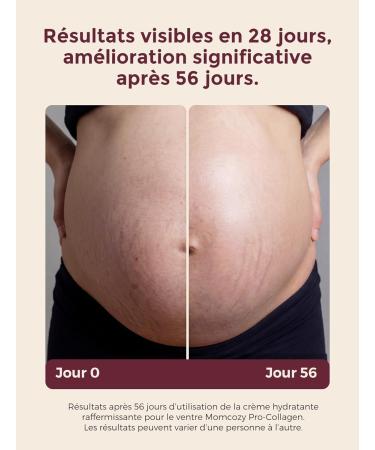 Momcozy Creme Vergeture Grossesse Format Voyage 30 g Cr me Peau S che Beurre Corporel Pr vention Vergetures Femme Enceinte Peptides & Beurre de Karit Soin de Grossesse 30 g (Lot de 1) - Buy Online on GoSupps.com
