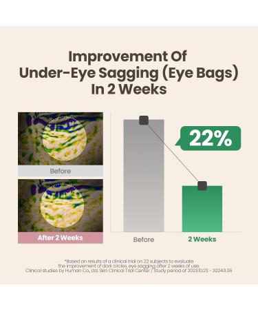 AXIS-Y Lip & Eye Set - Vita Glow Lip Oil Dreamy Olive & Vegan Collagen Eye Serum - Amazon Exclusive Korean Skin Care Kit - Limited Edition Hydra Barrier Duo for Lips & Eyes - Buy Online on GoSupps.com