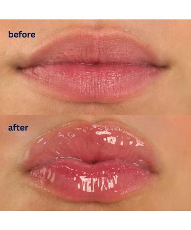 Endless Skin - Daydream - Natural Vanilla Flavor Lip Balm with Jojoba Oil Hyaluronic Acid and Squalane - Ultra Glossy Finish that Nourishes and Hydrates Your Lips - Vegan and Paraben Free - 15ml - Buy Online on GoSupps.com