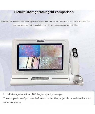 Hair Analyzer for Skin Diagnosis Hair Follicle Analyzer: 11 Inch High Resolution Scalp Detector with 10MP Camera 50x+200x Magnification for Oil Testing - Buy Online on GoSupps.com