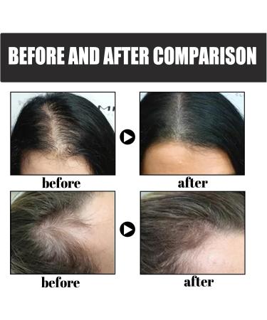 Layhou Hair Thickening Fiber Powder 12g Hair Building Fibers Increase Hair Volume Hair Loss Concealer for Men and Women Instantly Fuller Hair Dark Brown - Buy Online on GoSupps.com