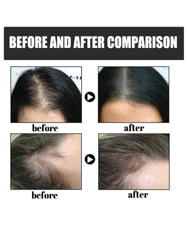 Hair Thickening Fiber Powder - 12g Hair Building Fibers for Men & Women | Instant Hair Loss Concealer & Fuller Look | Natural Black - Buy Online on GoSupps.com