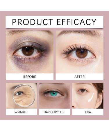 Contour des Yeux S rum Raffermissant S rum Contours Roller S rums Contour des Yeuxs Cr me Anti Cernes et Rides Instantan Repulpe Eclaircit Et r duit les Poches Sous les Yeux 10ML - Buy Online on GoSupps.com