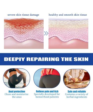 Likmind Heca Natural Herbal Hemorrhoid Relief Capsules - Rapid Treatment (1Box-7Pcs) - Buy Online on GoSupps.com