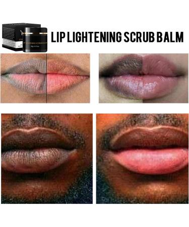 Lip Lightening Scrub Balm Lip Scrub Balm Lightening Brightening Dark/Smoker Lips 20g Dark Lips Lightening Treatment Lip Balm Scrub Lip Lightening Cream for Dark Lips for Women and Men 0.7 Fl Oz - Buy Online on GoSupps.com