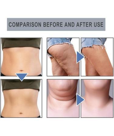 Buy Detoxifying Essential Oil Nose Ring | Latest Slimming & Weight Loss Septum Ring (3 Boxes) - Buy Online on GoSupps.com