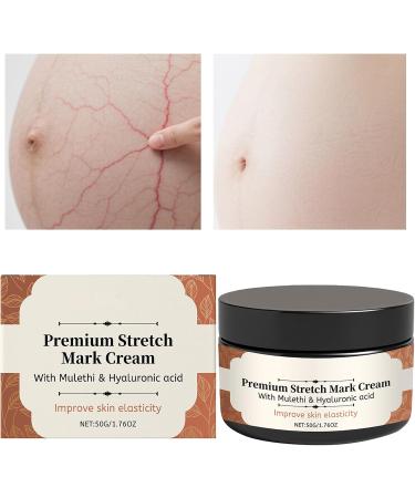  G n rique Stretch Mark Cream for Pregnancy | 50g Pregnancy Belly Care | Non-Greasy Texture Prevents Stretch Marks and Improves Skin Elasticity | Moisturizing and Preventative - Buy Online on GoSupps.com