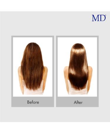 MD Revitalizing Shampoo and Conditioner - Nourish & Revive | 11 fl oz - International Shipping Available - Buy Online on GoSupps.com