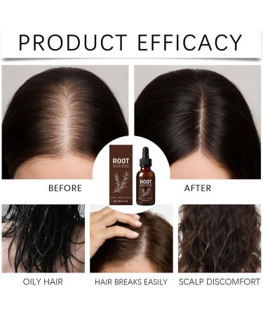 Scalp Oil For Hair Growth30ml Volume Solution Hair Strengthening Oil For Volume Scalp Care Frizz Control Strengthening Women Men Home & Travel - Buy Online on GoSupps.com