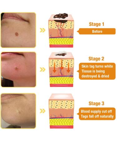 Miqicos Multi-Effect All-in-One Skincare Cream Skin Treatmen7-Day Quick Skin Repair Fine Line and Wrinkle Correction for All Skin Types (1) - Buy Online on GoSupps.com