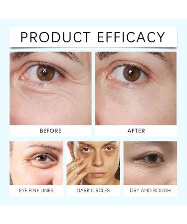 Under Eye Cream for Dark Circles and Puffiness - Caffeine Eye Cream Anti Aging Brightener With Niacinamide Peptide Complex Korean Skin Care Formula - Massage Zinc Roller - Puffy Eyes (2) - Buy Online on GoSupps.com