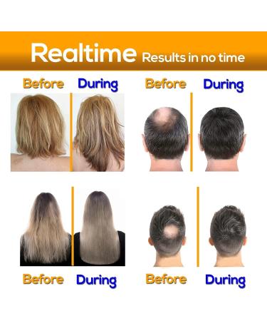 Biotin DHT Blocker Anti Dandruff Hair Growth Shampoo - 473ml | For Dry, Itchy Scalp, Hair Thinning & Dermatitis | Hair Loss Treatment for Women & Men - Buy Online on GoSupps.com