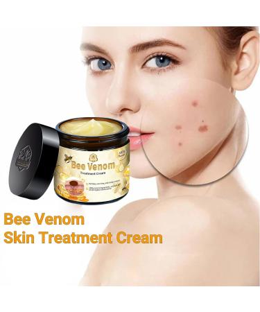 Bee Venom Skin Treatment Cream Bee Venom Cream Effectively reduces all types of skin blemishes(1PC) - Buy Online on GoSupps.com