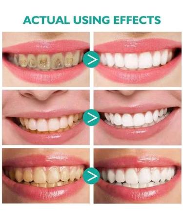 Herbal Mouth Rinsing Foam for Whitening & Gum Health | 2-Piece Set Tartar Removal & Bad Breath Reduction - Buy Online on GoSupps.com