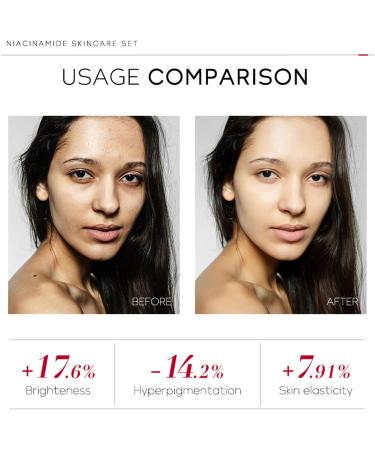 Niacinamide Skincare Set Skin Care Gift Set for Teen Girls Brightening Face Cream Pore Minimizer for Face Cleanser  - Buy Online on GoSupps.com