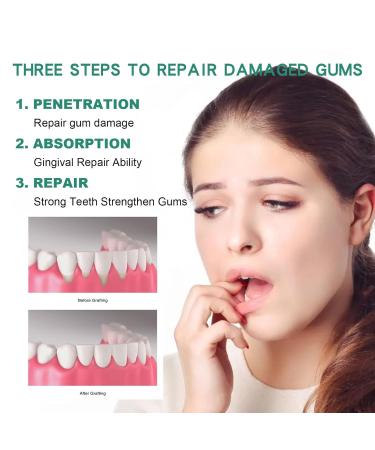 Dentiz Gums Growth Drops - Regrow & Repair Gums Treat Gum Diseases - 3PCs - Buy Online on GoSupps.com