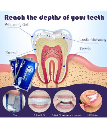 5D Teeth Whitening Strips Kit - Safe Effective Home Tooth Bleaching for Bright White Smiles - Buy Online on GoSupps.com