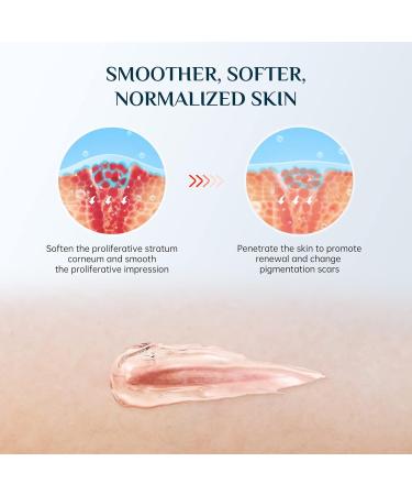Mebak Silicone Scar Gel - Scar Therapy for Old and New Scars - 30g - Buy Online on GoSupps.com