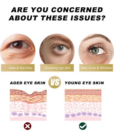 Retinol Eye Stick for Dark Circles Anti Aging Eye Cream Repairing Cream Anti Aging Eye Cream Moisturizing Firming and Lifting for Eye Skin (1pcs) - Buy Online on GoSupps.com