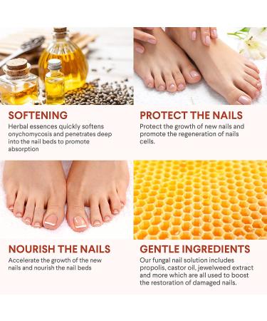 Extra Strength Toe Nail Fungus Treatment - Nail Repair Solution for Damaged Nails - Buy Online on GoSupps.com