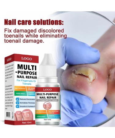 EUBEISAQI Multifunctional nail repair Nail renewal Nighttime Nail 10ml Fungi Fingernail & Toe Nail Solution for broken cracked and discolored nails or fingernails - Buy Online on GoSupps.com