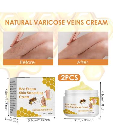  Elitecran Varicose Vein Cream with Bee Poison Varicose Vein Treatment Cream for Legs Repairing Balm for - Buy Online on GoSupps.com