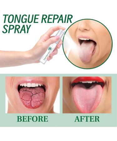 Buy Tongue Repair Spray Set (3 x 30ml) - Reduce Swelling & Freshen Breath | Effective Tongue Relief Treatment - Buy Online on GoSupps.com