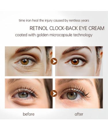 Retinol Eye Cream Anti Aging Eye Cream with Retinol Serum Aha 30% & Bha 2% Under Eye Cream for Women/Men Skincare Eye Cream for Dark Circles Puffy Eyes Reduce Fine Lines Brightening Eye Repair Cream - Buy Online on GoSupps.com