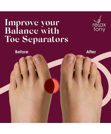 Anatomical Gel Toe Separators & Straighteners | Hammer Toe Separator for Foot Pain Relief | Toe Spacers for Overlapping Toes & Bunion Corrector | Men & Women (White) - Buy Online on GoSupps.com