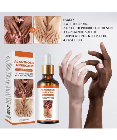 Acanthosis Nigricans Therapy Oil - Dark Spot Corrector Serum - 50ml (2pcs) - Buy Online on GoSupps.com