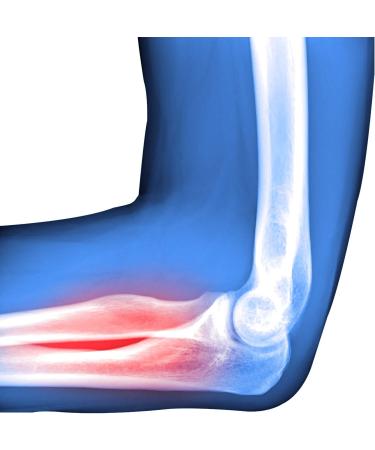 SOLES Tennis and Golfer Elbow Strap Brace (SLS509) - Pain Relief & Support for Active Lifestyles | Shop Internationally Now - Buy Online on GoSupps.com