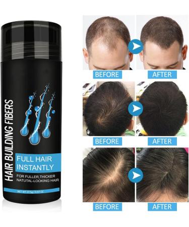 Hair Building Fibers Professional Quality Fibre Hair Powder Spray Hair Fibres Dark Brown Hair Loss Concealer for Men and Women for Bald Spots & Thinning Hair (Dark Brown) - Buy Online on GoSupps.com