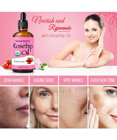 Natural Riches Organic Rosehip Seed Oil - 100% Pure Cold Pressed Unrefined Non-GMO Carrier Oil for Skin Hair & Nails - 4 fl oz - Buy Online on GoSupps.com