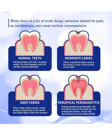 KLYso Premium Oral Care Toothpaste - Whitening Anti-Cavity Gum Protection & Fresh Breath(1PCS) - Buy Online on GoSupps.com