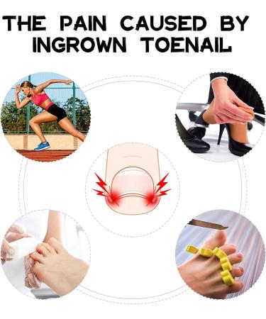 (12 +3) Ingrown Toenail Correction Treatment Kit 12 pcs Ingrown Toenail Corrector Straightener Strips Recover Clips with 3 pcs Ingrown Toenail File And Lifter - Buy Online on GoSupps.com
