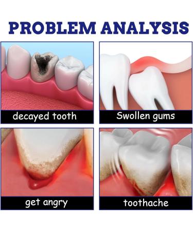 2pcs Toothache Relieving Spray Toothache Relief Spray Oral Care Spray Instant Teeth Treatment Relief Toothache Sprays Toothache Care Spray Freshen Breath and Improve Oral Health Dental Pain Relief - Buy Online on GoSupps.com