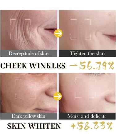 24K Collagen Anti Wrinkle Face Cream - Moisturiser Face Women - Collagen Cream for Face - Face Moisturizer for Dry Skin - Anti Wrinkle Cream for Women - Buy Online on GoSupps.com
