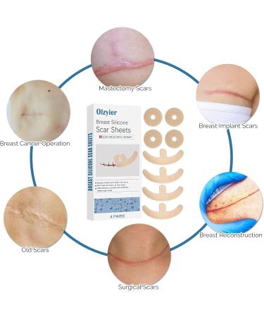 Silicone Scar Sheets for Breast | 8 Pack Invisible Surgical Scars Removal Tape | Scar Treatment for Recovery & Reduction - Buy Online on GoSupps.com