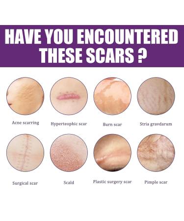 Actsyl-3 Silicone Scar Removal Sheets - Professional Grade for Surgery, Burns, Keloids & Stretch Marks - Reusable for Old & New Scars - 4 Sheets for Glowing Skin Care - One Size - Buy Online on GoSupps.com