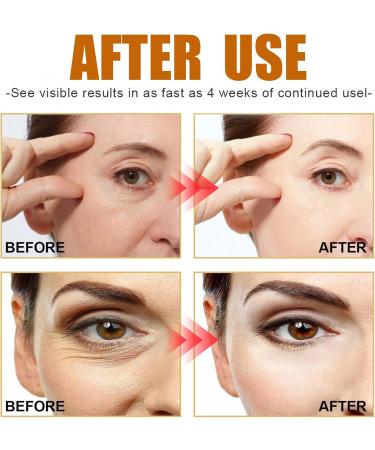 Caffeine Solution 30ml Antioxidant Face Serum for Women High Firming Skin Serum Hyaluronic Acid Serum for Face Relieve Redness & Promote Skin Collagen Niacinamide Serum for Face Fade Puffiness on Face - Buy Online on GoSupps.com